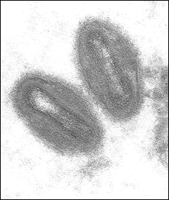 A microscopic view of the monkeypox virus.